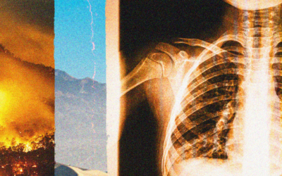 California could face another record-breaking year of Valley fever