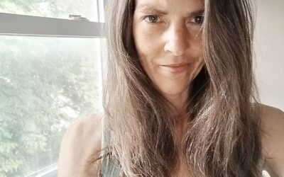I was left with horrific fourth-degree burns after trying habit of 17m Americans for first time